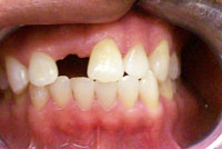 P Ballinger before